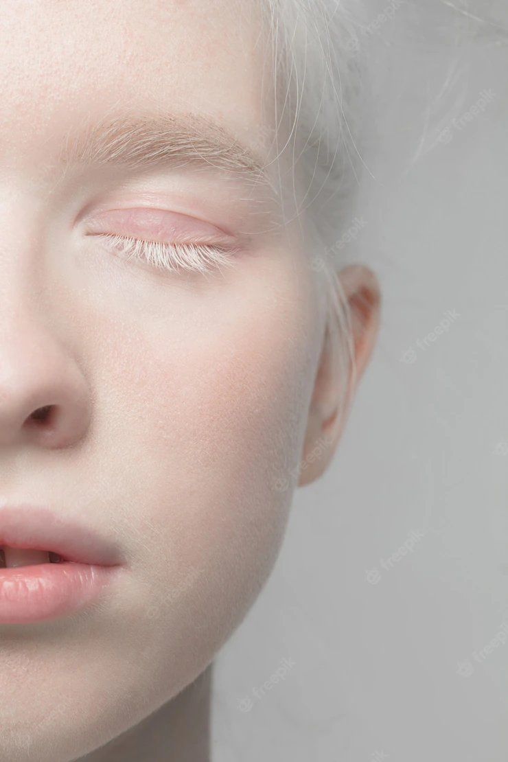 Close up portrait of beautiful albino woman isolated on studio. . details. Free Photo