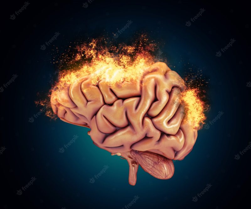 3d render of a brain with flames Free Photo