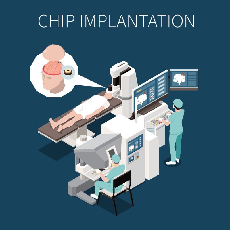 Chip implantation isometric background Free Vector