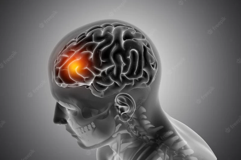 Male medical figure with front of the brain highlighted Free Photo`1