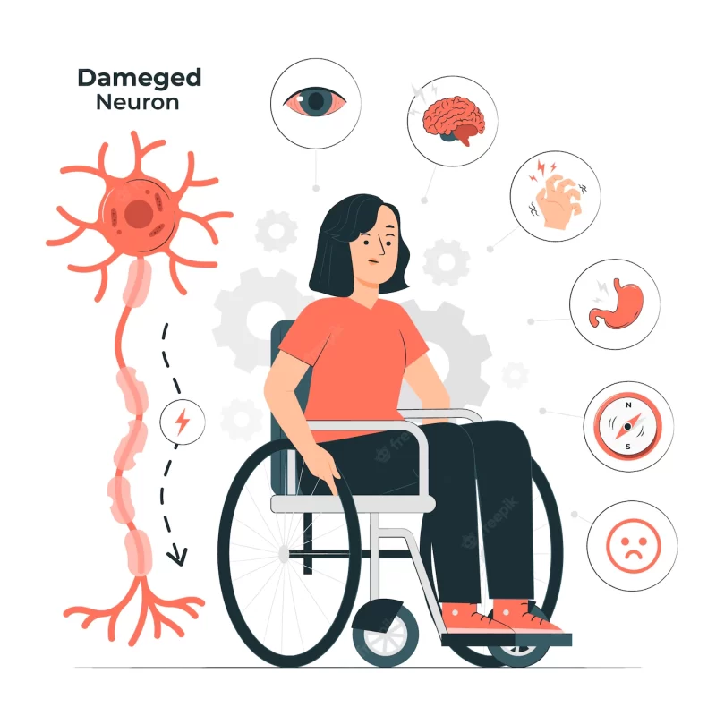 Multiple sclerosis concept illustration Free Vector